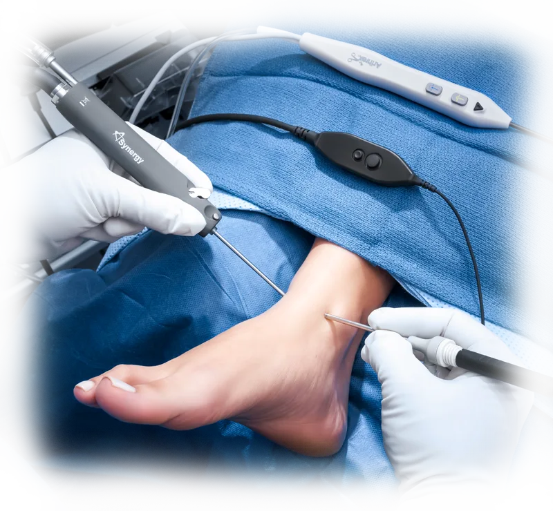 Procedimiento Artroscópico