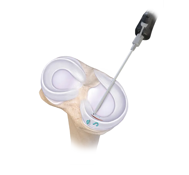 Set Instrumentos Artroscopia